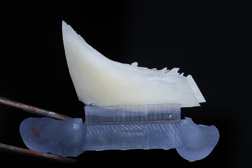 guided-bone-harvesting guided-bone-harvesting